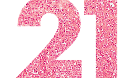 breast cancer